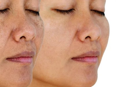MorySkin stellt vor: jalupro super hydro für strahlende Haut